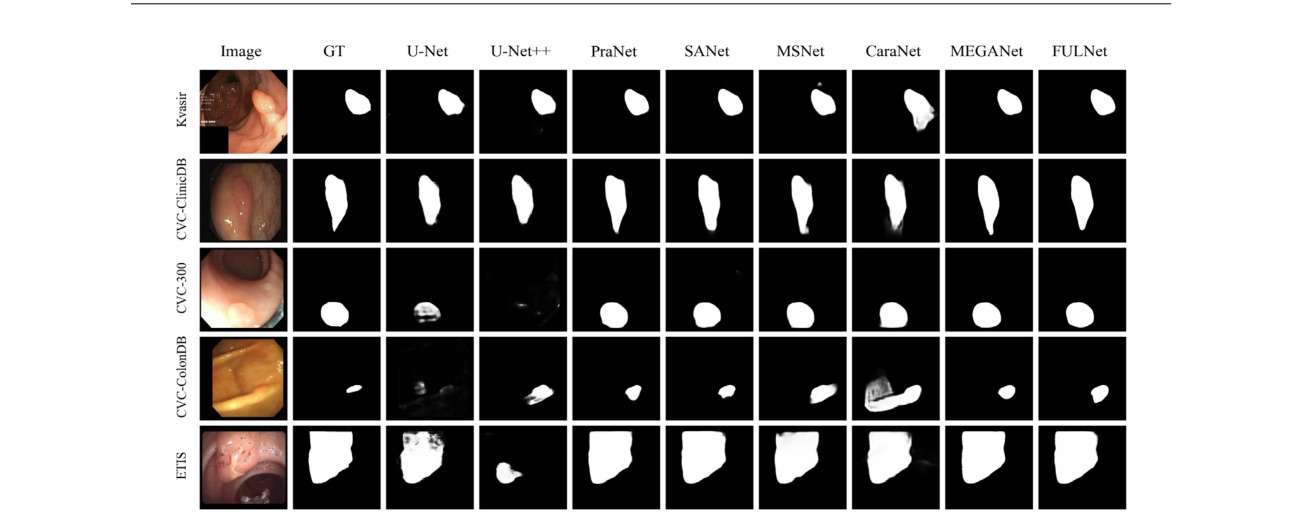 Frequency-augmented and uncertainty-aware learning for polyp segmentation 主要结果