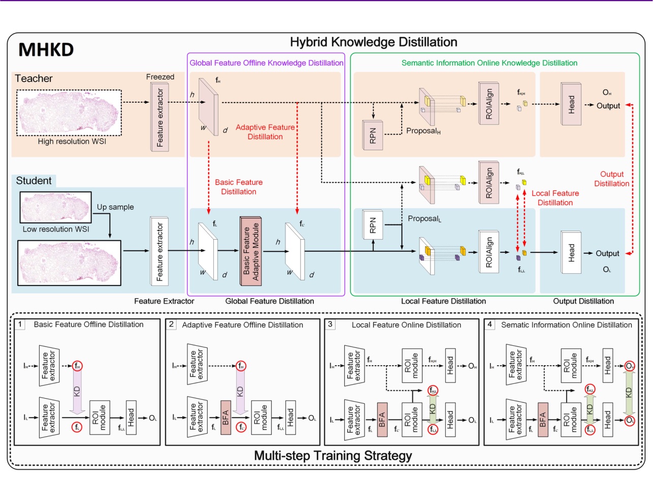 MHKD: Multi-Step Hybrid Knowledge Distillation for Low-Resolution Whole Slide Images Glomerulus Detection 示意图