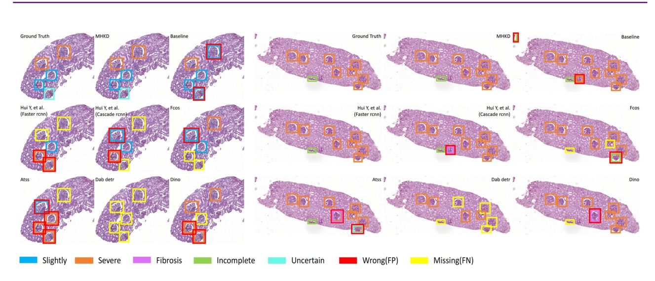 MHKD: Multi-Step Hybrid Knowledge Distillation for Low-Resolution Whole Slide Images Glomerulus Detection 主要结果
